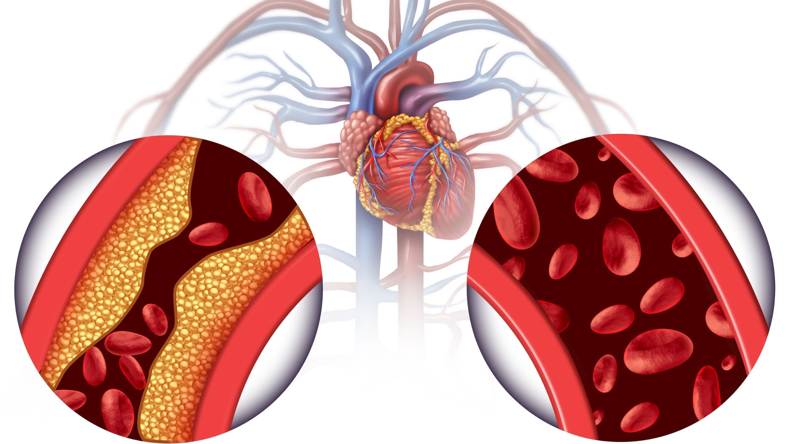 Detox IV infusion therapy at ResCore Clinic